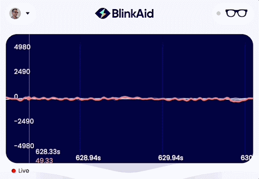 Real-time EMG signal during frown